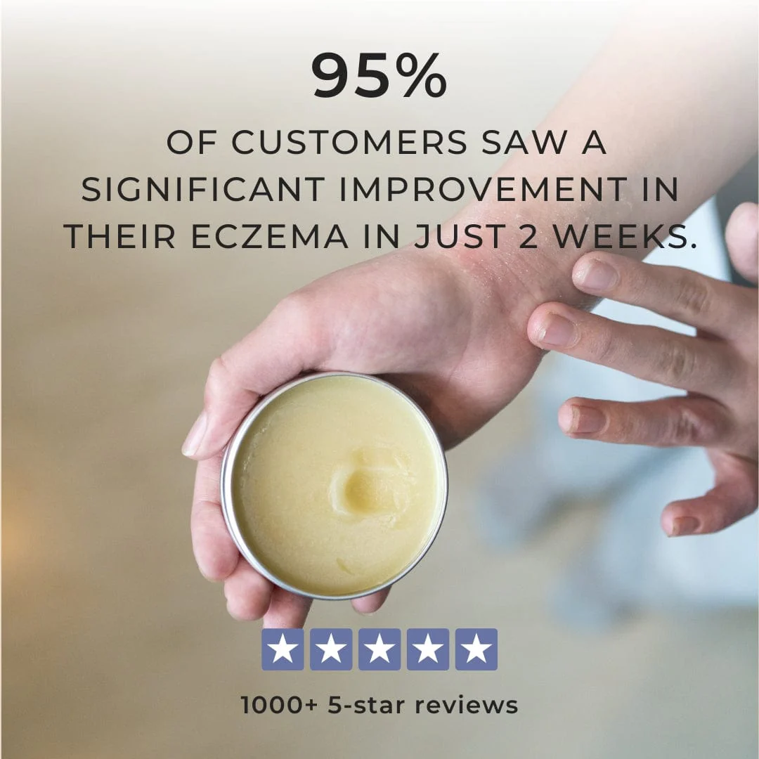 The Complete Eczema Defence System - Image 13
