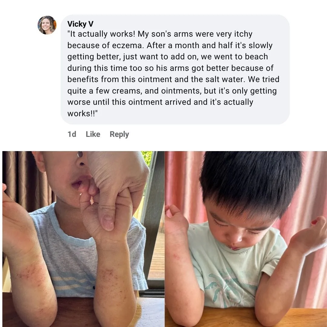 The Complete Eczema Defence System - Image 9