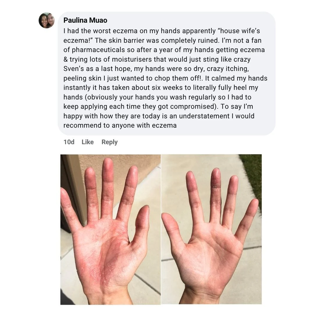 The Complete Eczema Defence System - Image 10